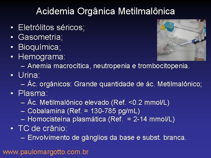 Acidemia Orgânica Metilmalônica • • Eletrólitos séricos; Gasometria; Bioquímica; Hemograma: – Anemia macrocítica, neutropenia