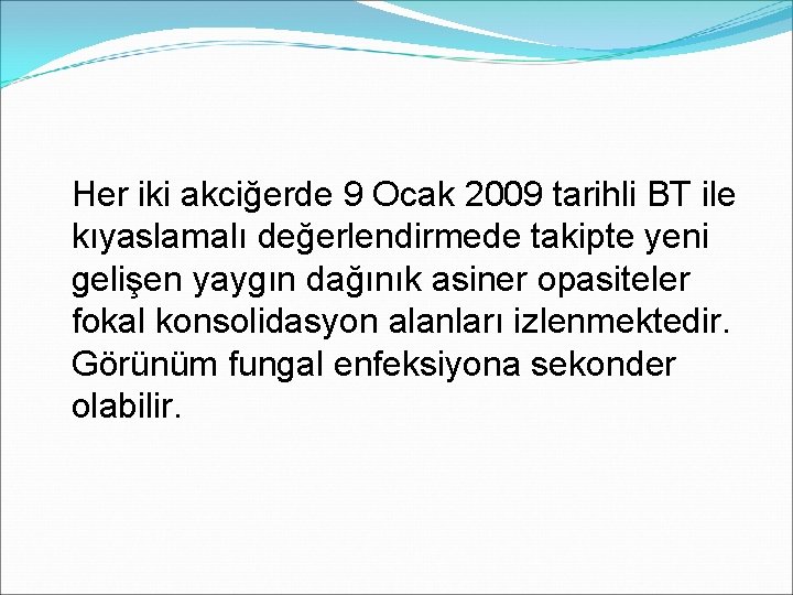 Her iki akciğerde 9 Ocak 2009 tarihli BT ile kıyaslamalı değerlendirmede takipte yeni gelişen