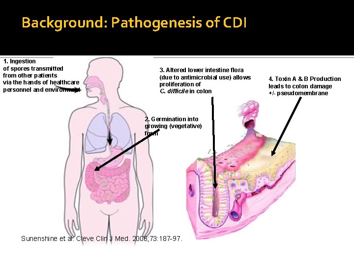 Background: Pathogenesis of CDI 1. Ingestion of spores transmitted from other patients via the