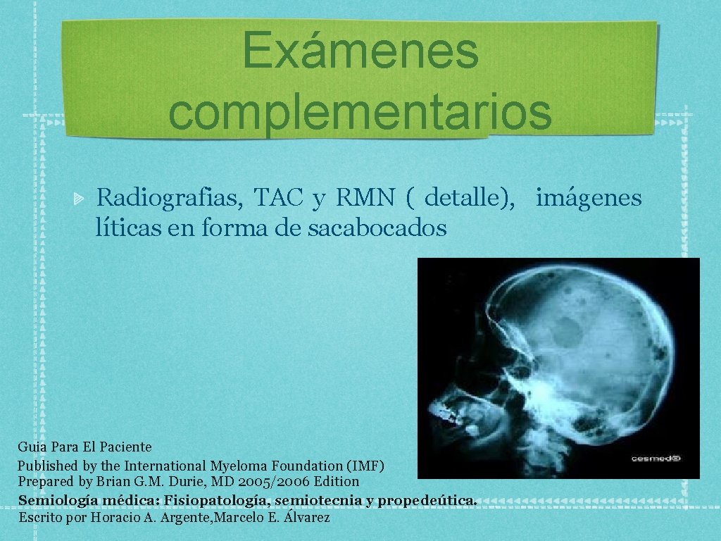 Exámenes complementarios Radiografias, TAC y RMN ( detalle), imágenes líticas en forma de sacabocados