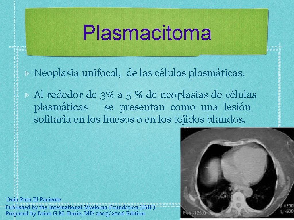 Plasmacitoma Neoplasia unifocal, de las células plasmáticas. Al rededor de 3% a 5 %