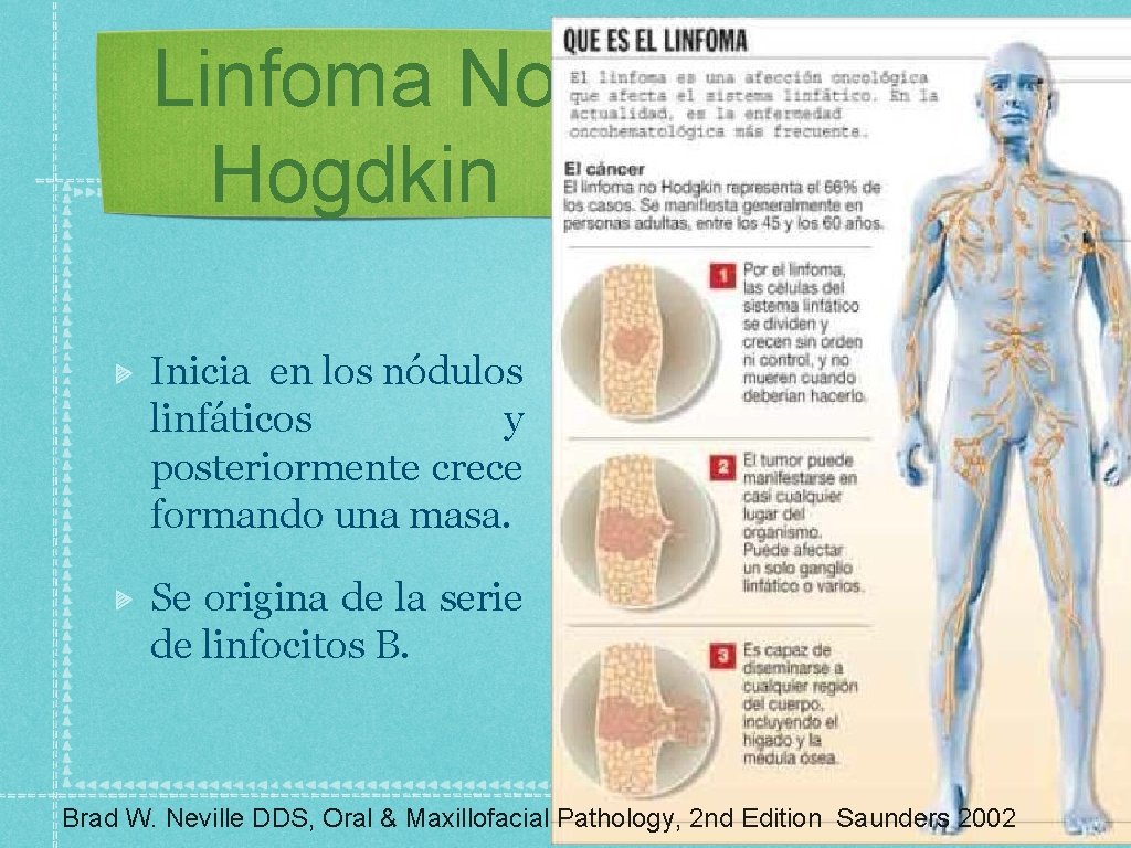 Linfoma No Hogdkin Inicia en los nódulos linfáticos y posteriormente crece formando una masa.