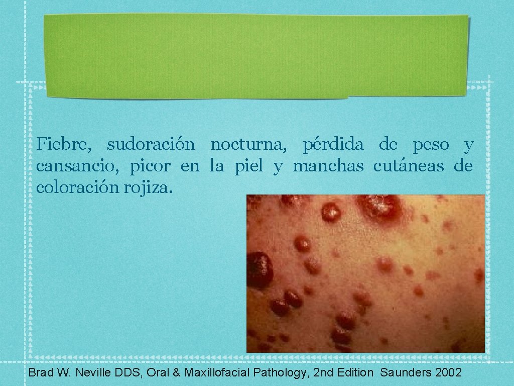 Fiebre, sudoración nocturna, pérdida de peso y cansancio, picor en la piel y manchas