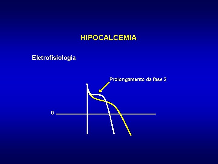 HIPOCALCEMIA Eletrofisiologia Prolongamento da fase 2 0 