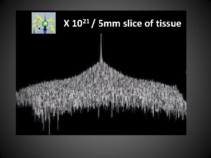 X 1021 / 5 mm slice of tissue 