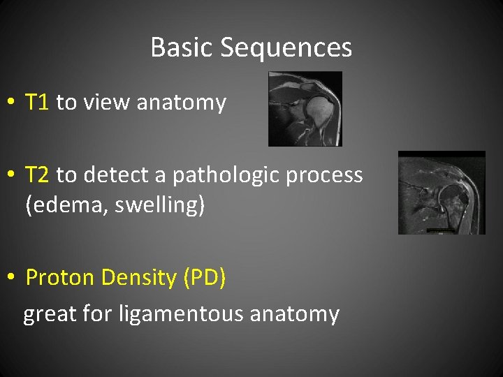 Basic Sequences • T 1 to view anatomy • T 2 to detect a