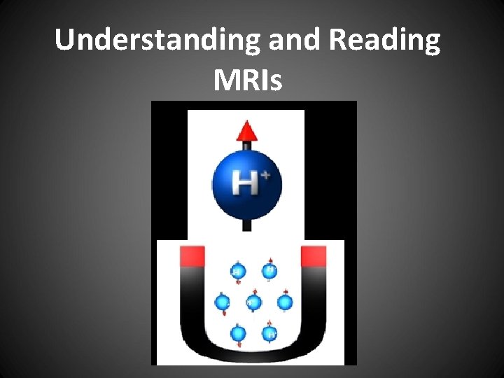 Understanding and Reading MRIs 