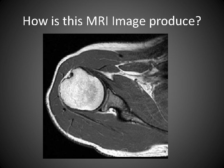 How is this MRI Image produce? 