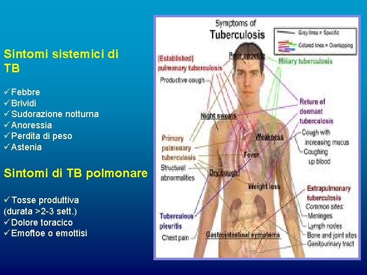 Sintomi sistemici di TB üFebbre üBrividi üSudorazione notturna üAnoressia üPerdita di peso üAstenia Sintomi