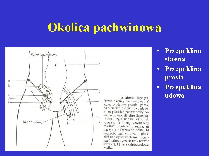 Okolica pachwinowa • Przepuklina skośna • Przepuklina prosta • Przepuklina udowa 