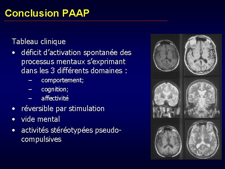 Conclusion PAAP Tableau clinique • déficit d’activation spontanée des processus mentaux s’exprimant dans les