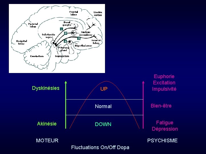 Dyskinésies Akinésie UP Euphorie Excitation Impulsivité Normal Bien-être DOWN Fatigue Dépression MOTEUR PSYCHISME Fluctuations