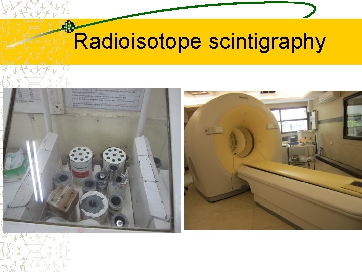 Radioisotope scintigraphy 