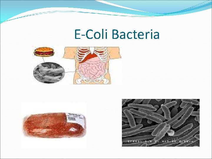 E-Coli Bacteria 