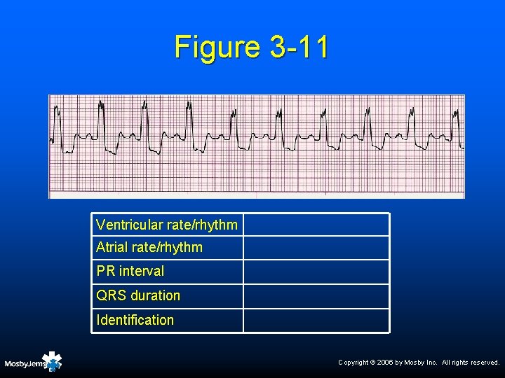 Figure 3 -11 Ventricular rate/rhythm Atrial rate/rhythm PR interval QRS duration Identification Copyright ©