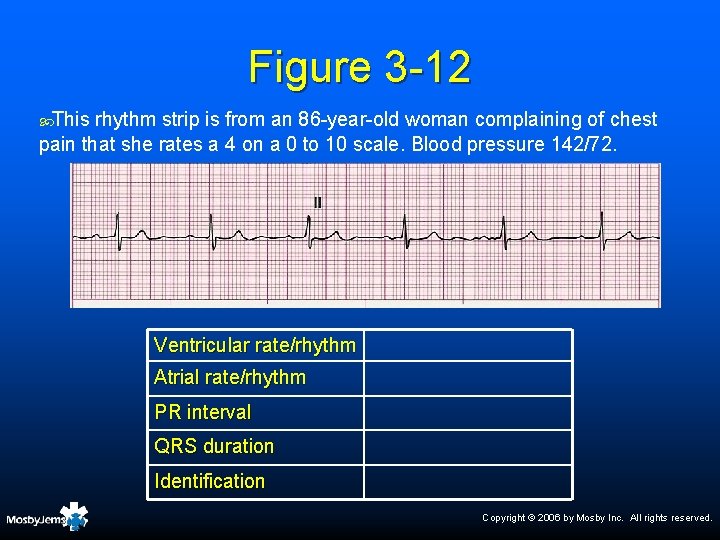 Figure 3 -12 This rhythm strip is from an 86 -year-old woman complaining of