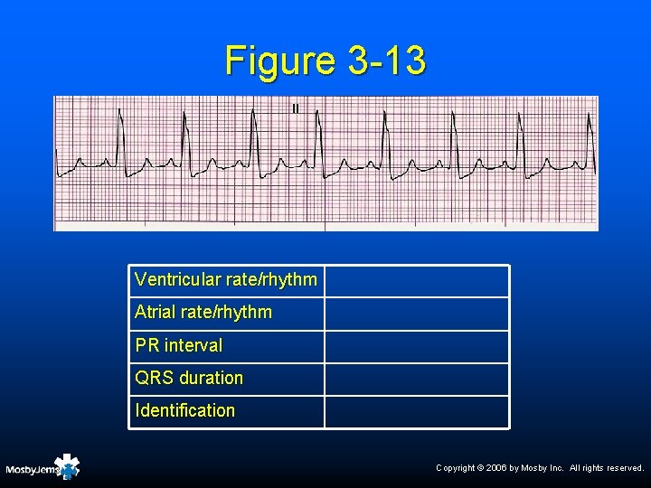 Figure 3 -13 Ventricular rate/rhythm Atrial rate/rhythm PR interval QRS duration Identification Copyright ©