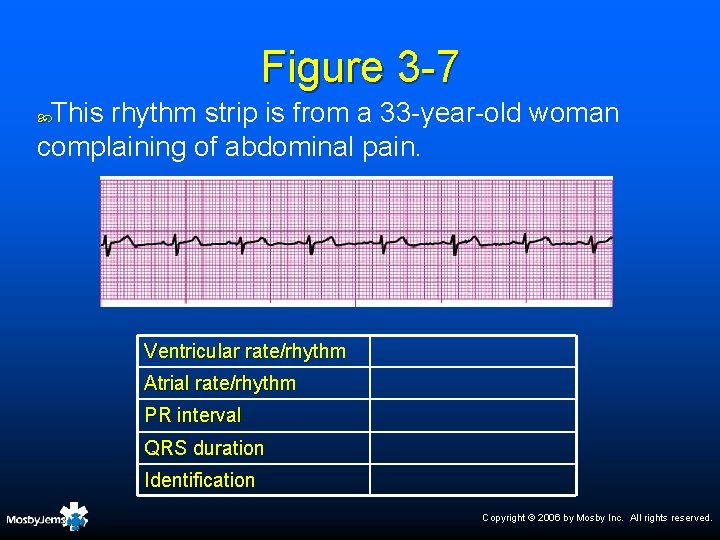Figure 3 -7 This rhythm strip is from a 33 -year-old woman complaining of