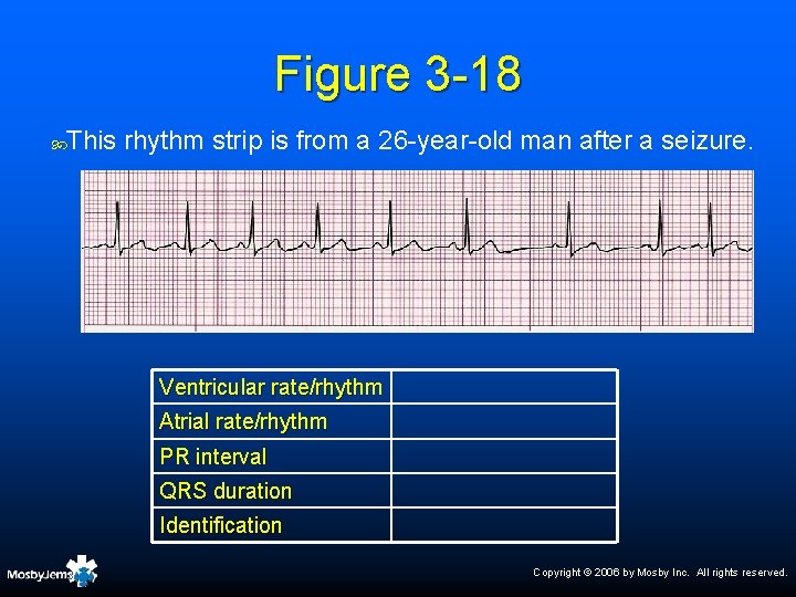 Figure 3 -18 This rhythm strip is from a 26 -year-old man after a