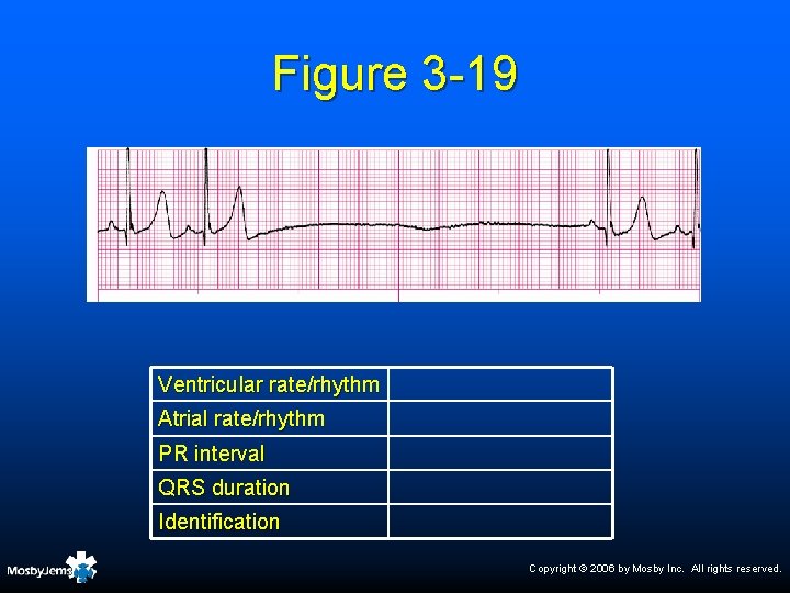 Figure 3 -19 Ventricular rate/rhythm Atrial rate/rhythm PR interval QRS duration Identification Copyright ©