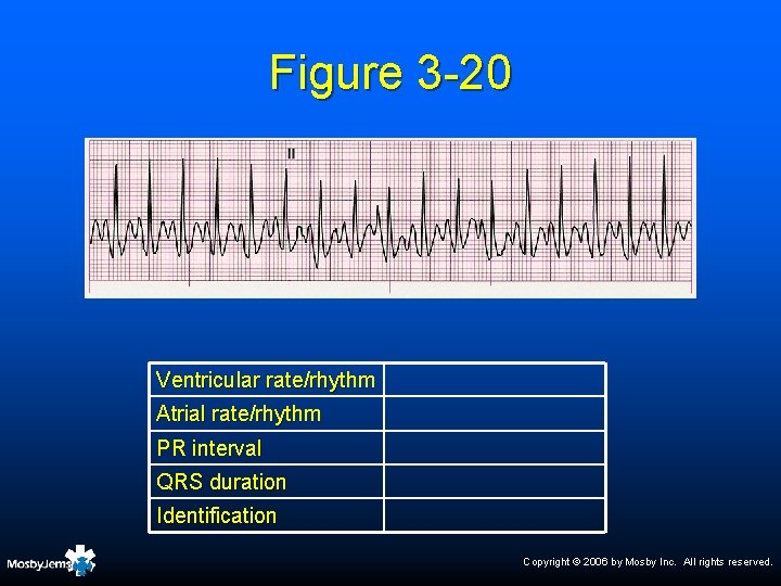 Figure 3 -20 Ventricular rate/rhythm Atrial rate/rhythm PR interval QRS duration Identification Copyright ©