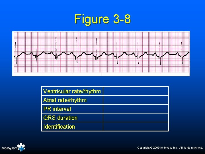 Figure 3 -8 Ventricular rate/rhythm Atrial rate/rhythm PR interval QRS duration Identification Copyright ©