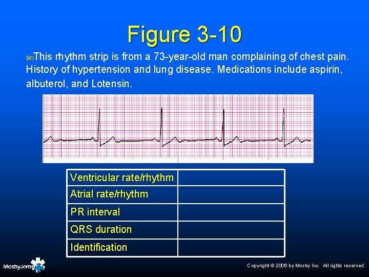 Figure 3 -10 This rhythm strip is from a 73 -year-old man complaining of