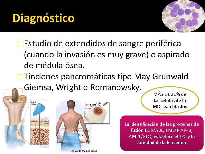 Diagnóstico �Estudio de extendidos de sangre periférica (cuando la invasión es muy grave) o