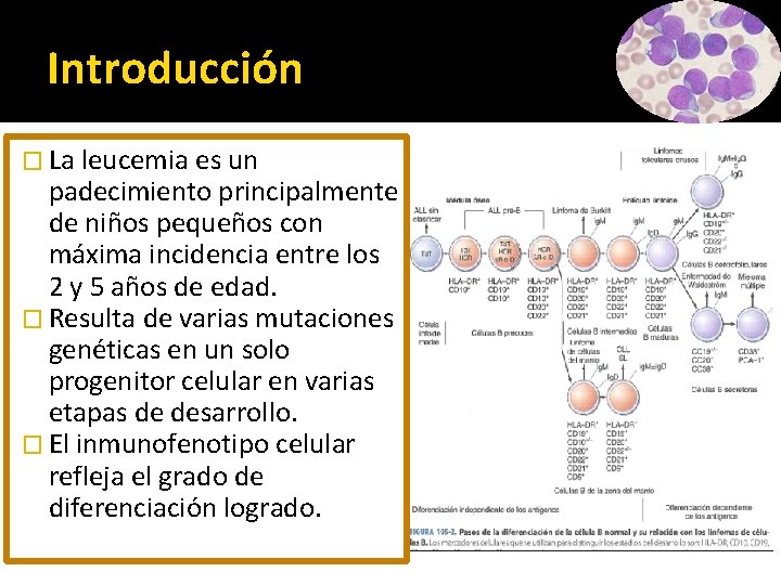 Introducción � La leucemia es un padecimiento principalmente de niños pequeños con máxima incidencia