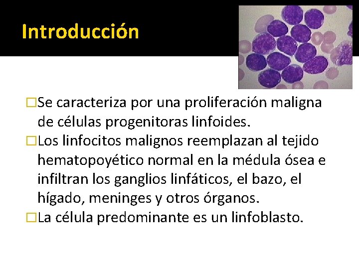Introducción �Se caracteriza por una proliferación maligna de células progenitoras linfoides. �Los linfocitos malignos