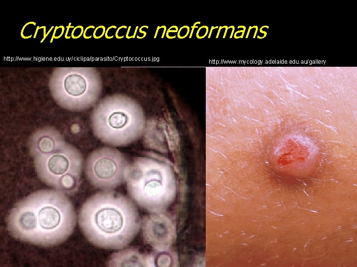 Cryptococcus neoformans http: //www. higiene. edu. uy/ciclipa/parasito/Cryptococcus. jpg http: //www. mycology. adelaide. edu. au/gallery