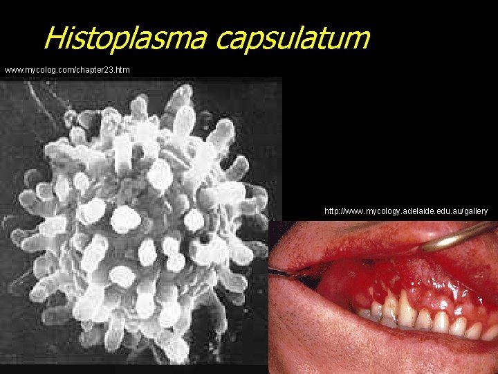 Histoplasma capsulatum www. mycolog. com/chapter 23. htm http: //www. mycology. adelaide. edu. au/gallery 