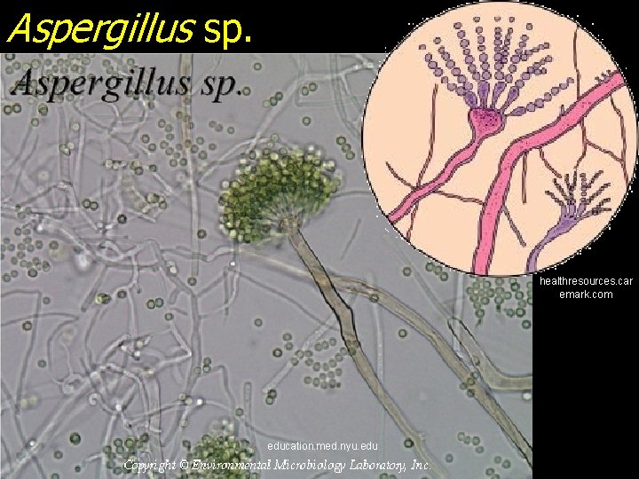 Aspergillus sp. healthresources. car emark. com education. med. nyu. edu 