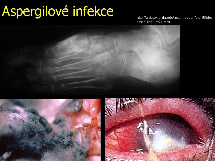 Aspergilové infekce http: //webs. wichita. edu/mschneegurt/biol 103/lec ture 21/lecture 21. html 