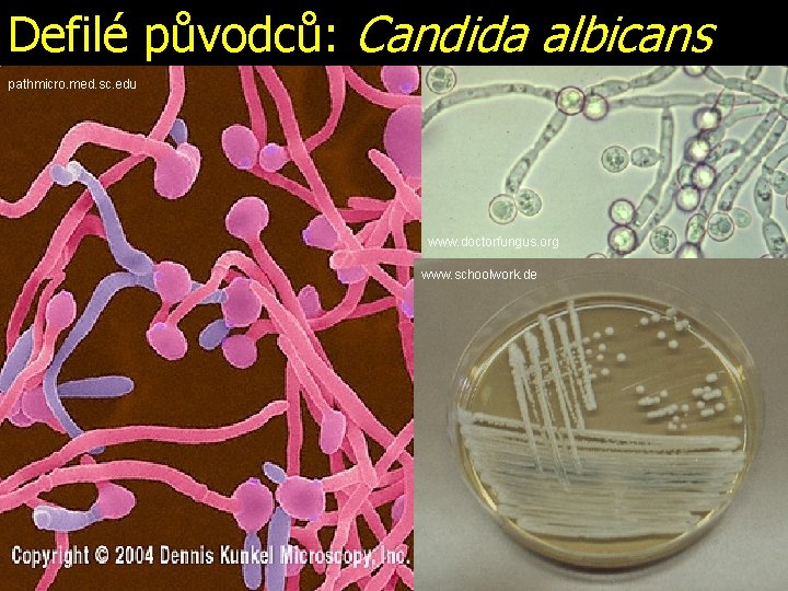 Defilé původců: Candida albicans pathmicro. med. sc. edu www. doctorfungus. org www. schoolwork. de