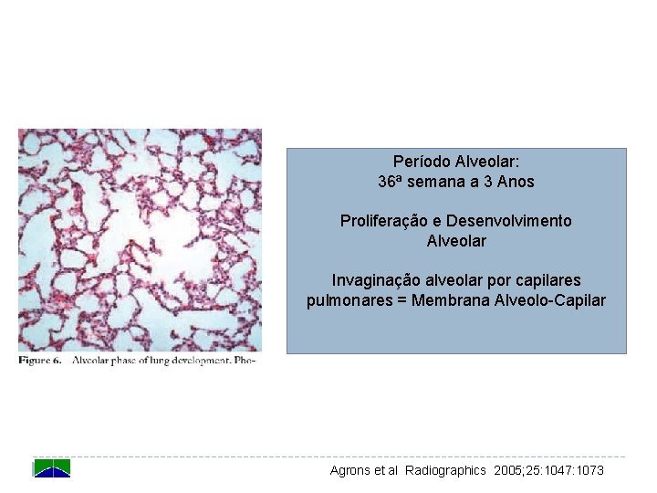 Período Alveolar: 36ª semana a 3 Anos Proliferação e Desenvolvimento Alveolar Invaginação alveolar por