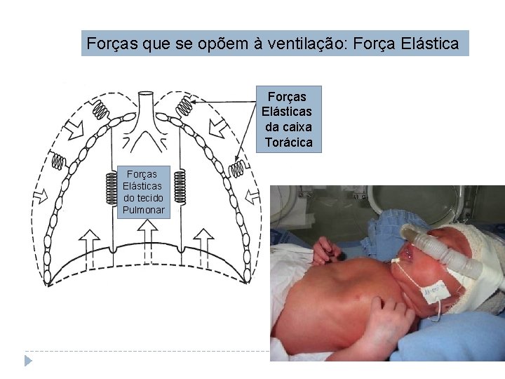 Forças que se opõem à ventilação: Força Elástica Forças Elásticas da caixa Torácica Forças
