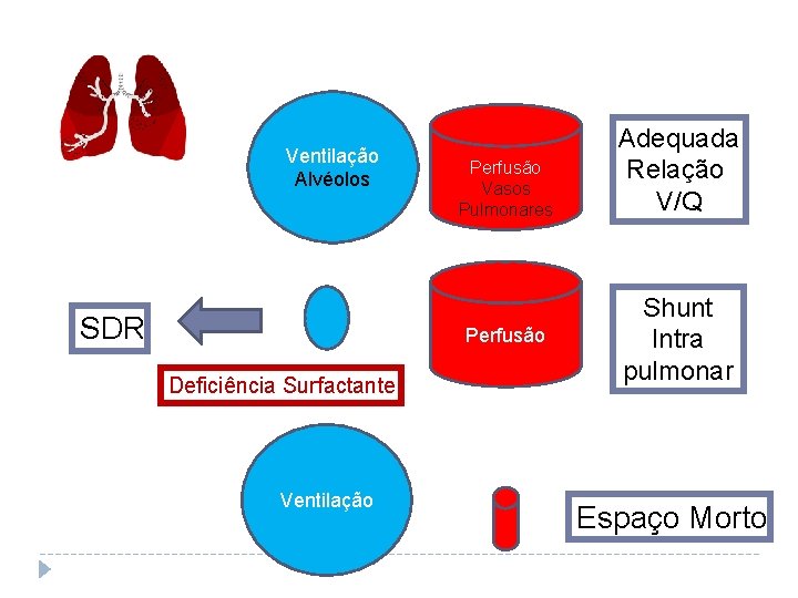 Ventilação Alvéolos SDR Perfusão Vasos Pulmonares Perfusão Deficiência Surfactante Ventilação Adequada Relação V/Q Shunt