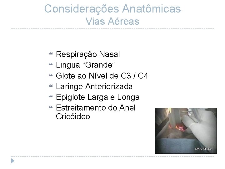 Considerações Anatômicas Vias Aéreas Respiração Nasal Lingua “Grande” Glote ao Nível de C 3