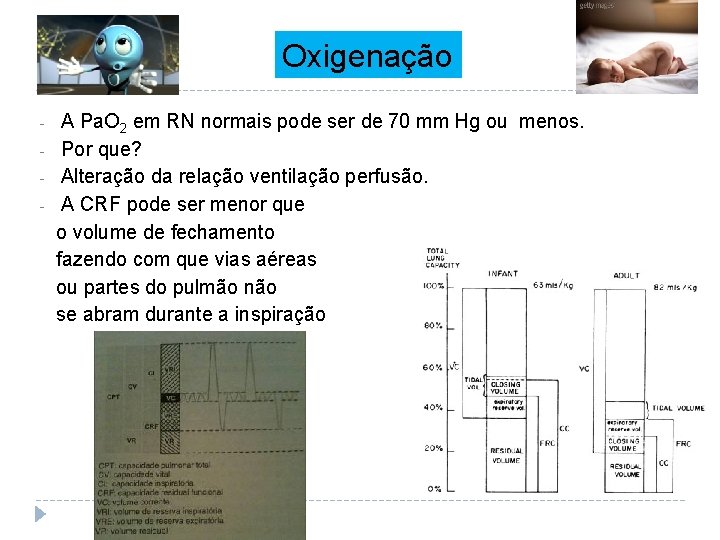 Oxigenação - A Pa. O 2 em RN normais pode ser de 70 mm