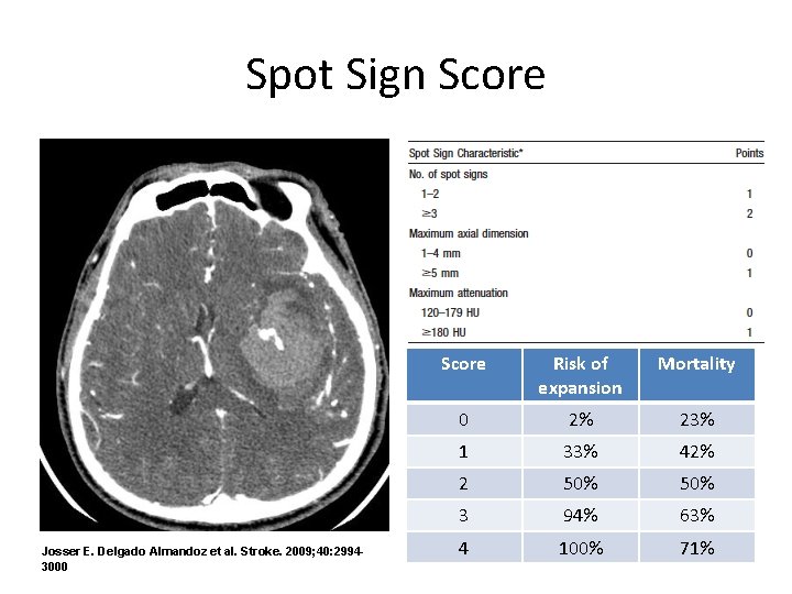 Spot Sign Score Josser E. Delgado Almandoz et al. Stroke. 2009; 40: 29943000 Score