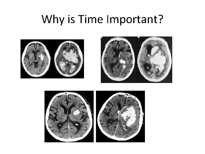 Why is Time Important? 