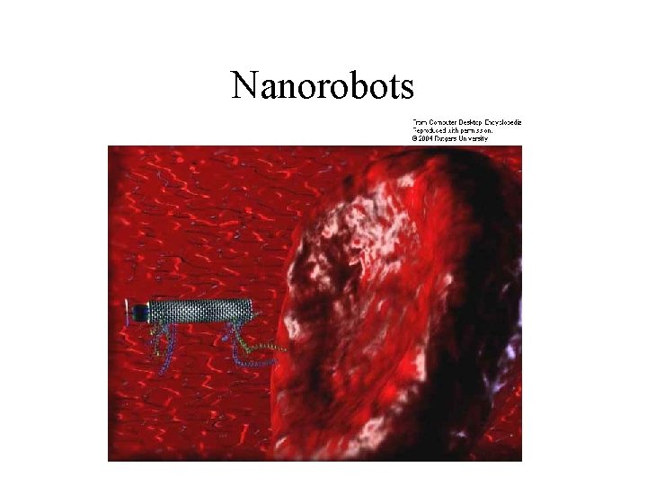 Nanorobots 