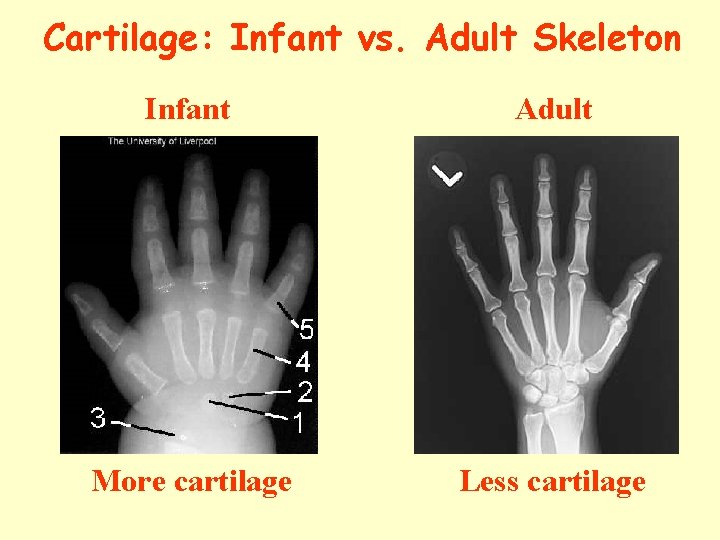 Cartilage: Infant vs. Adult Skeleton Infant Adult More cartilage Less cartilage 