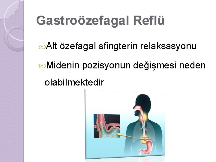 Gastroözefagal Reflü Alt özefagal sfingterin relaksasyonu Midenin pozisyonun değişmesi neden olabilmektedir 