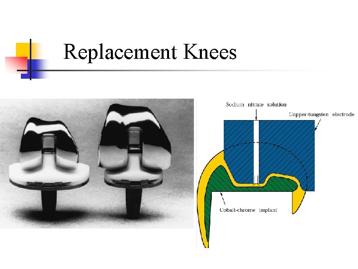 Replacement Knees 