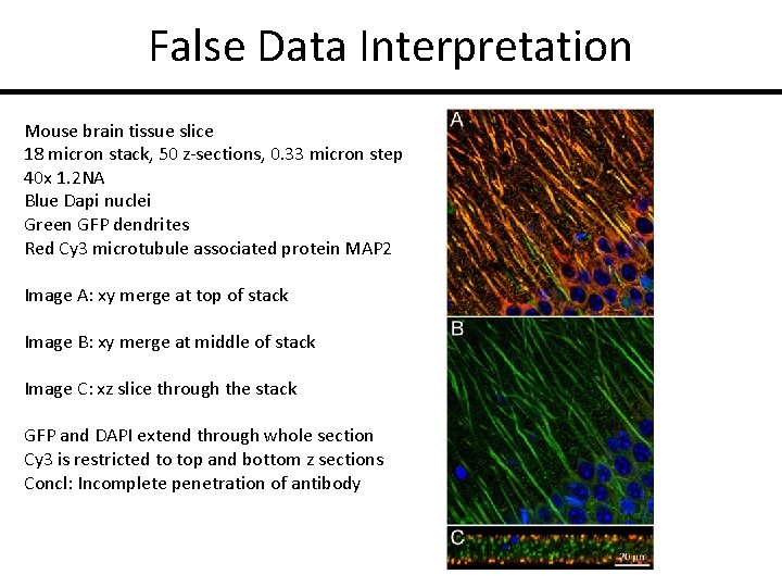 False Data Interpretation Mouse brain tissue slice 18 micron stack, 50 z-sections, 0. 33