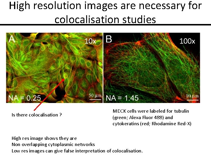 High resolution images are necessary for colocalisation studies 10 x Is there colocalisation ?