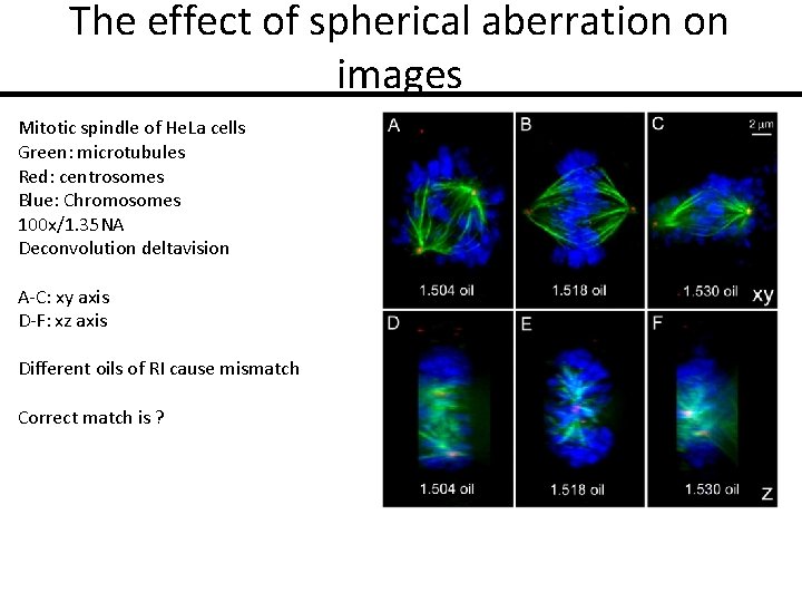 The effect of spherical aberration on images Mitotic spindle of He. La cells Green:
