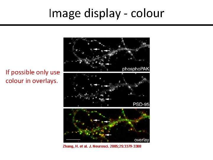 Image display - colour If possible only use colour in overlays. Zhang, H. et
